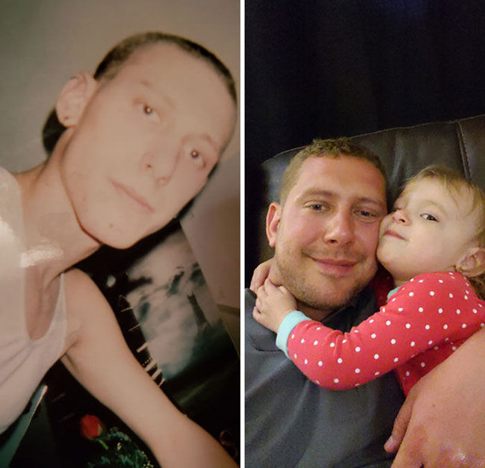 38 Stunning Before &#038; After Transformations Of People Who Quit Drugs