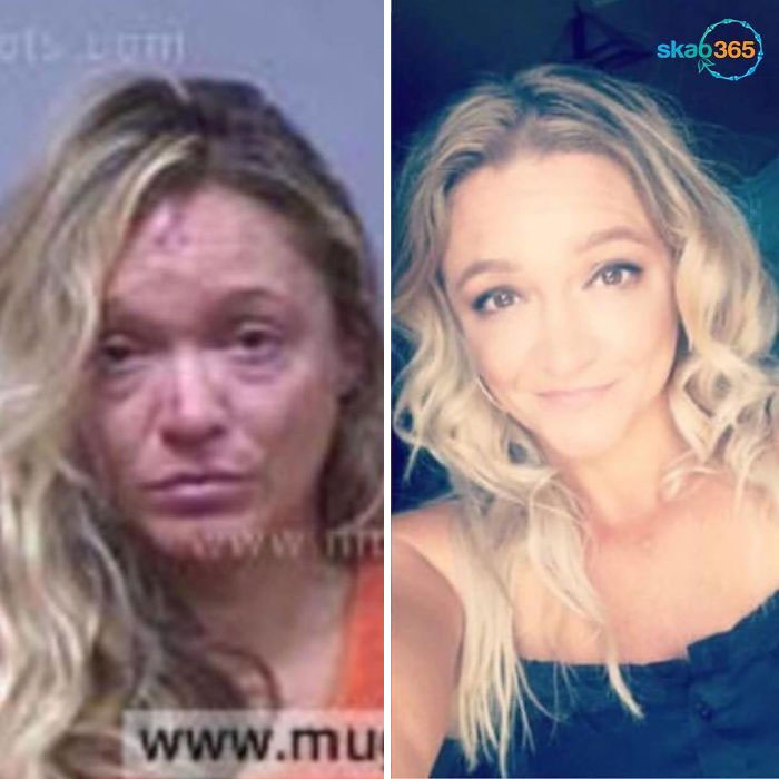 38 Stunning Before &#038; After Transformations Of People Who Quit Drugs