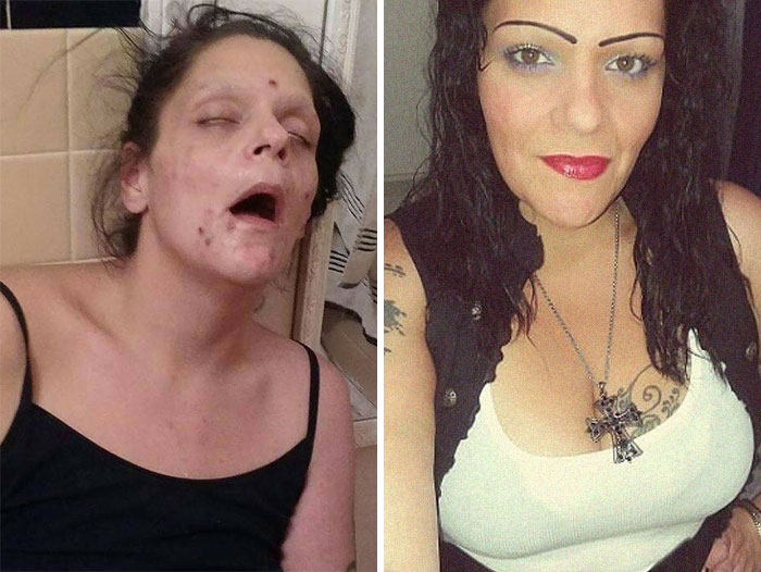 38 Stunning Before &#038; After Transformations Of People Who Quit Drugs