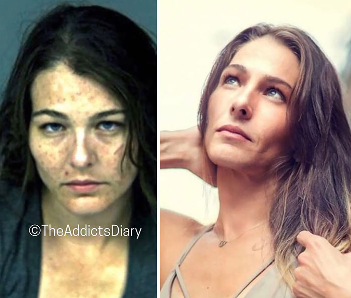 38 Stunning Before &#038; After Transformations Of People Who Quit Drugs