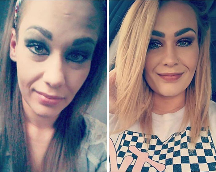 38 Stunning Before &#038; After Transformations Of People Who Quit Drugs