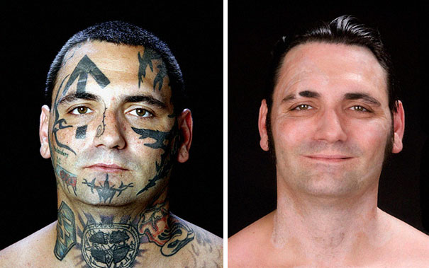 ‘I Was Totally Prepared To Douse My Face In Acid:’ Ex-Skinhead Gets His Racist Tattoos Removed After Becoming A Dad ‘I Was Totally Prepared To Douse My Face In Acid:’ Ex-Skinhead Gets His Racist Tattoos Removed After Becoming A Dad