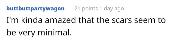 ‘I Was Totally Prepared To Douse My Face In Acid:’ Ex-Skinhead Gets His Racist Tattoos Removed After Becoming A Dad ‘I Was Totally Prepared To Douse My Face In Acid:’ Ex-Skinhead Gets His Racist Tattoos Removed After Becoming A Dad