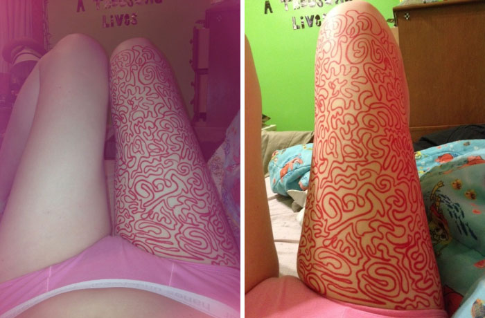 Girl Shares Therapist&#8217;s Advice To Draw On Her Body Instead Of Cutting