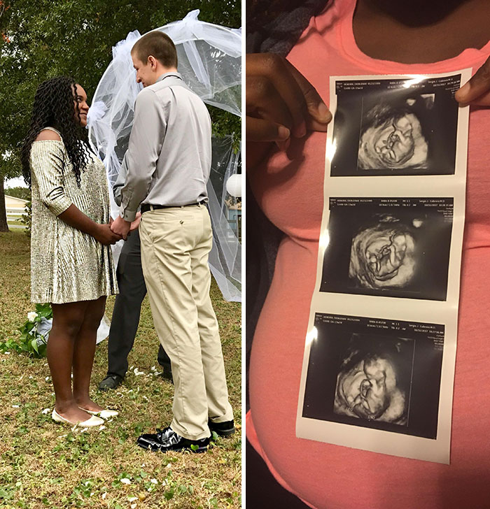 30 Suicide Survivors Share How Happy They Finally Are 30 Suicide Survivors Share How Happy They Finally Are