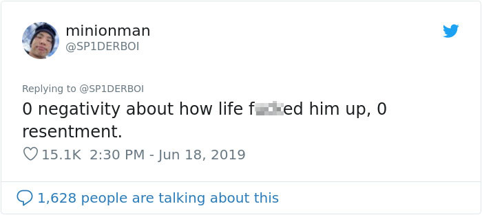 Man Given 0.1% Chance By Doctors After Motorbike Accident Where He Lost Half Of His Brain Makes Incredible Recovery Man Given 0.1% Chance By Doctors After Motorbike Accident Where He Lost Half Of His Brain Makes Incredible Recovery