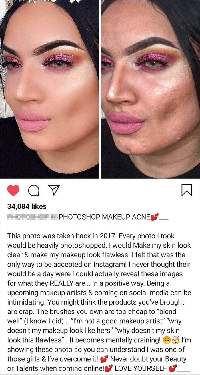 30 Times Instagrammers Showed The World Their ‘Real’ Bodies, And The Internet Admired Their ‘Sanity’ 30 Times Instagrammers Showed The World Their ‘Real’ Bodies, And The Internet Admired Their ‘Sanity’