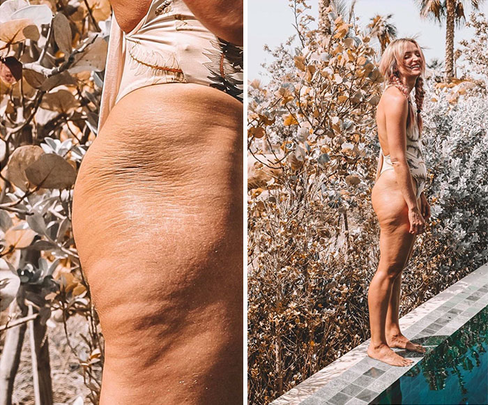 30 Times Instagrammers Showed The World Their ‘Real’ Bodies, And The Internet Admired Their ‘Sanity’ 30 Times Instagrammers Showed The World Their ‘Real’ Bodies, And The Internet Admired Their ‘Sanity’