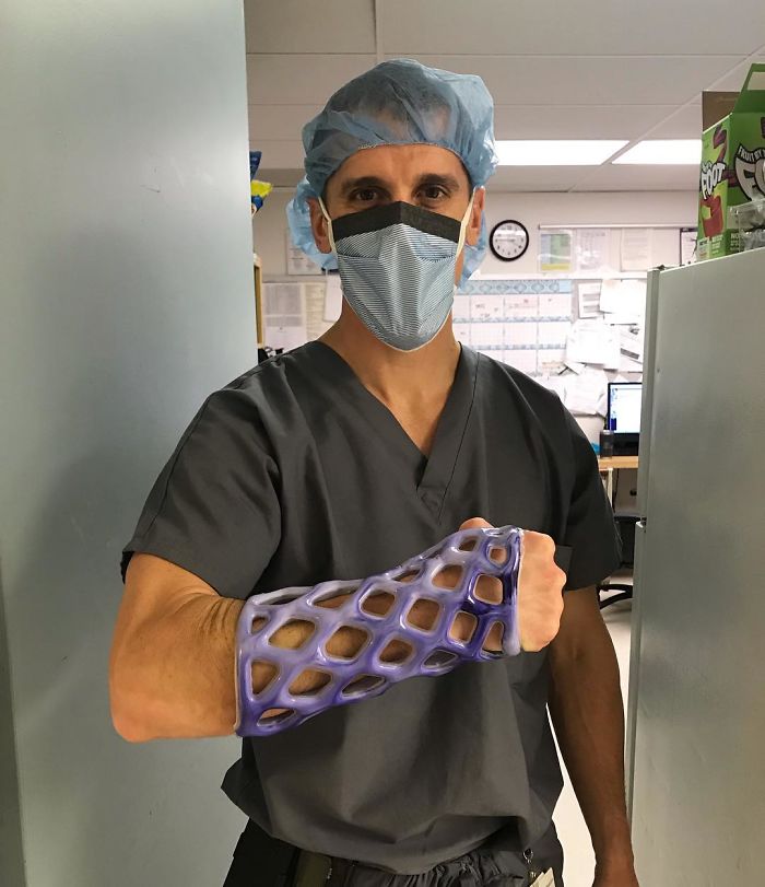 Engineers Create A Breathable And Waterproof Cast To Replace Plaster Ones And Stop The Itching Forever Engineers Create A Breathable And Waterproof Cast To Replace Plaster Ones And Stop The Itching Forever