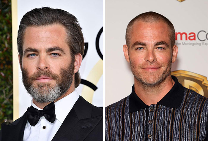 30 Celebs Before And After They Shaved Their Heads 30 Celebs Before And After They Shaved Their Heads