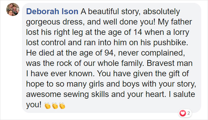 To Encourage A Little Girl Who Was Born Without An Arm, This Woman Shares Stunning Photos Of Herself As Cinderella With A Glass Arm To Encourage A Little Girl Who Was Born Without An Arm, This Woman Shares Stunning Photos Of Herself As Cinderella With A Glass Arm