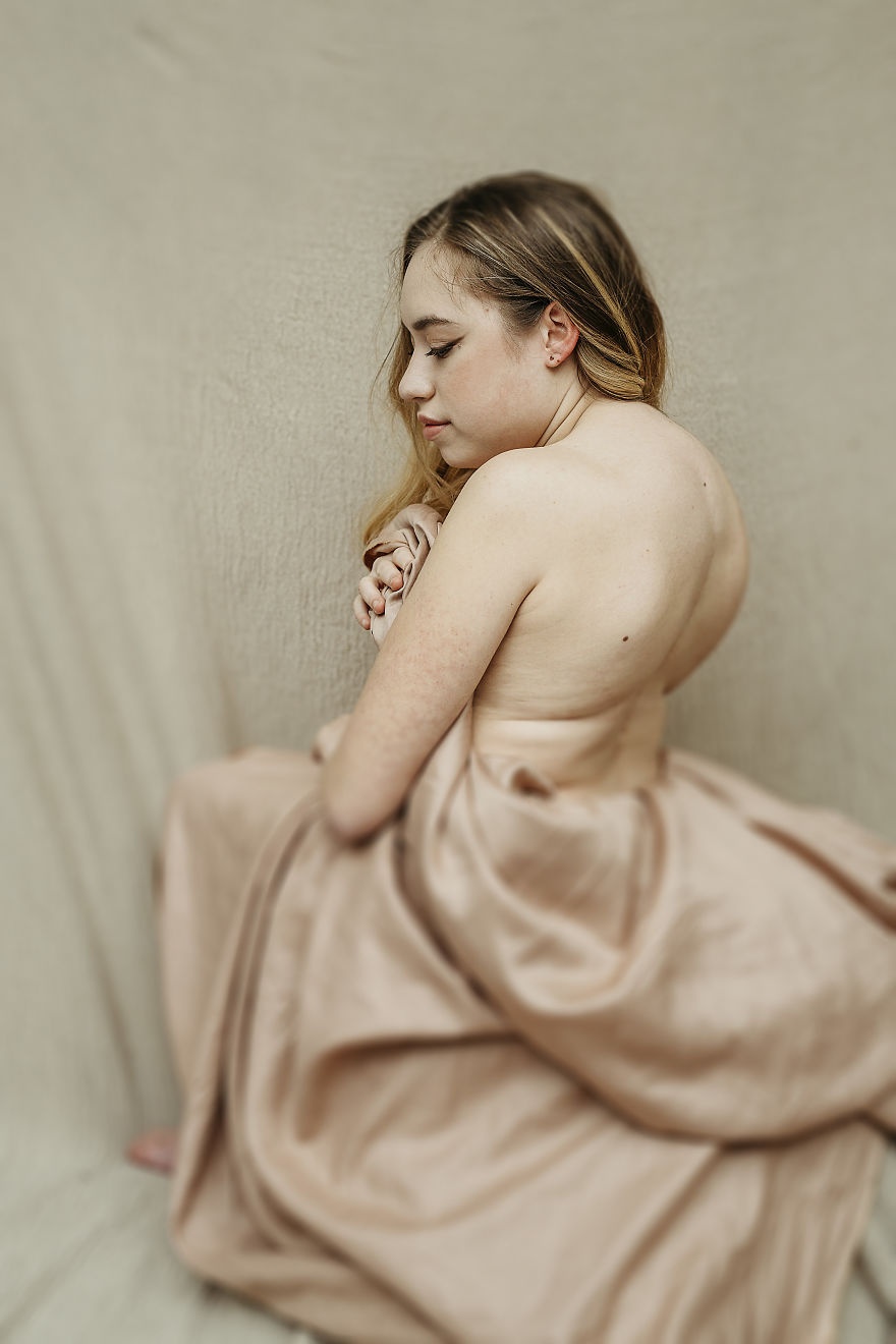 For This International Women‘s Day We Did A Special Photoshoot With Women That Represent People With Disabilities And Visible Differences For This International Women‘s Day We Did A Special Photoshoot With Women That Represent People With Disabilities And Visible Differences