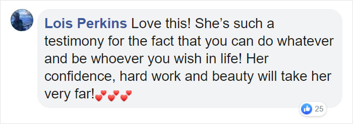 People Are Celebrating This Model With Down Syndrome Who Just Rocked New York Fashion Week