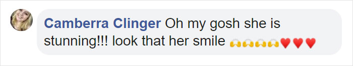 People Are Celebrating This Model With Down Syndrome Who Just Rocked New York Fashion Week