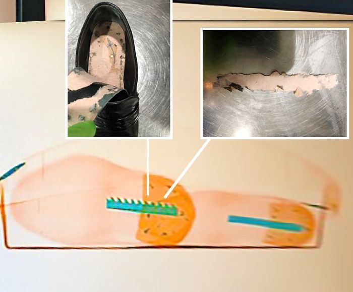 TSA Instagram Account Posts The Strangest Things They Confiscate (30 Pics) TSA Instagram Account Posts The Strangest Things They Confiscate (30 Pics)