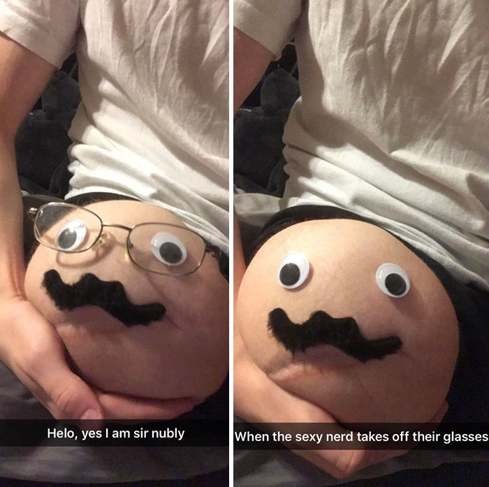 30 People With Illnesses And Disabilities Overshining Their Hardships With Humor 30 People With Illnesses And Disabilities Overshining Their Hardships With Humor