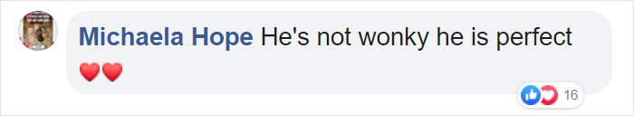 Dog Finally Gets Adopted After His Mother’s Attack Left His Face Wonky Dog Finally Gets Adopted After His Mother’s Attack Left His Face Wonky