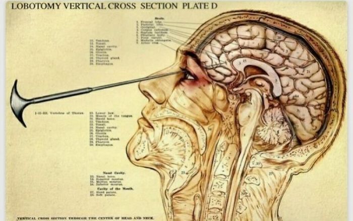 Is Time To See Some Bizarre Customs That Our Ancestors Had Is Time To See Some Bizarre Customs That Our Ancestors Had