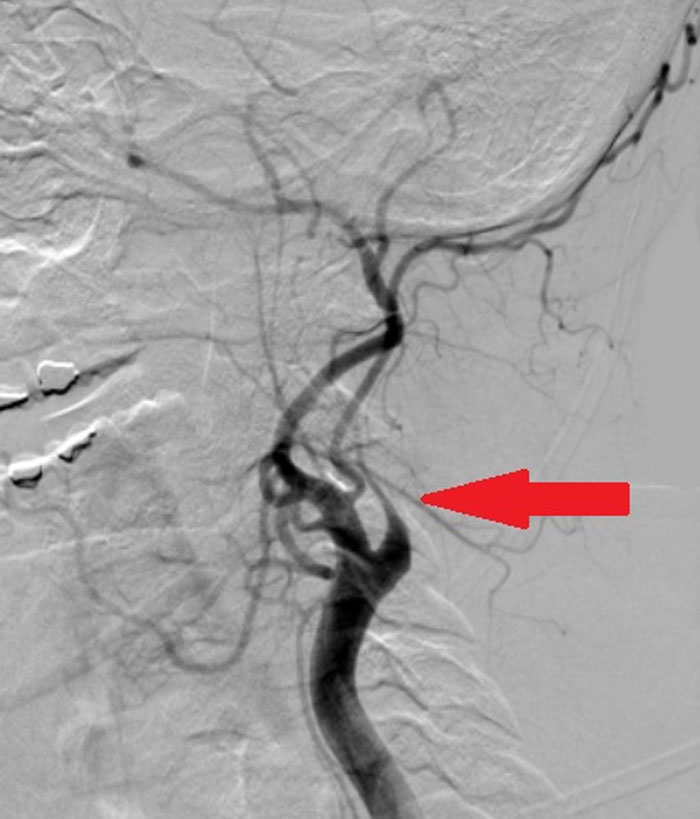 5-Year-Old Notices Mom Collapsing So She FaceTimes Her Dad, And People Are Saying The Family Would Be Broke If It Were The US