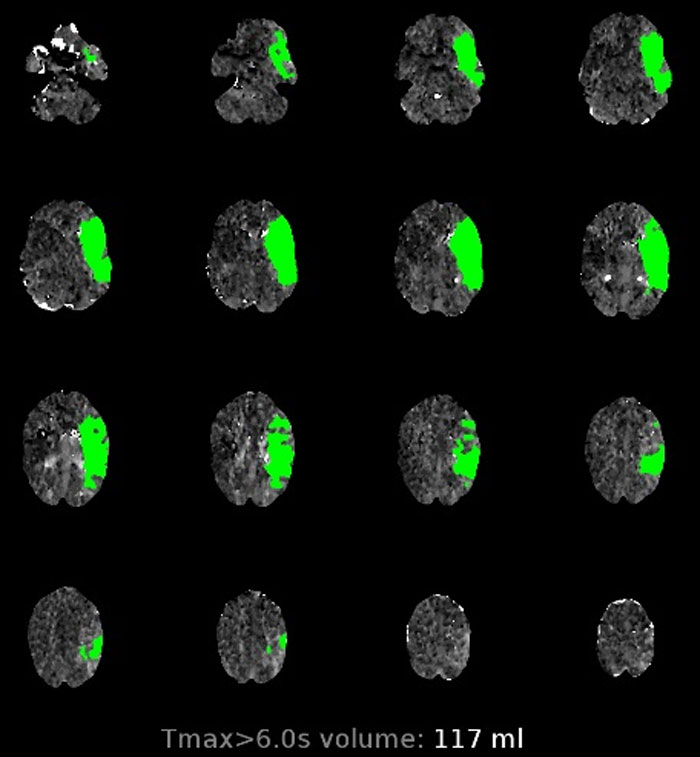 5-Year-Old Notices Mom Collapsing So She FaceTimes Her Dad, And People Are Saying The Family Would Be Broke If It Were The US