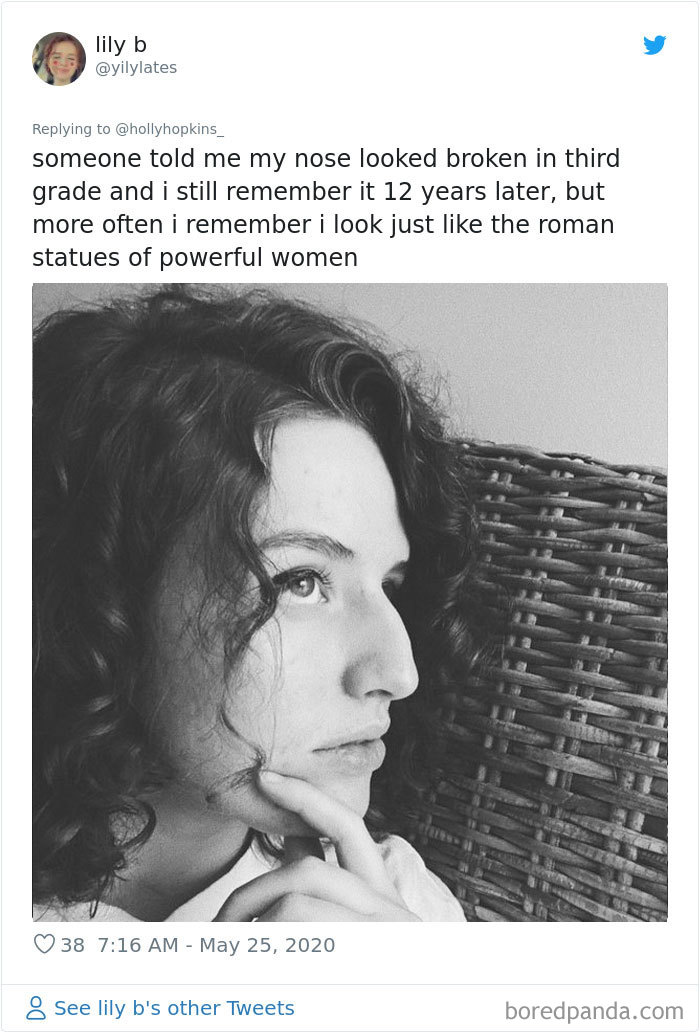 Women Are Posting Their Noses That Look Like “Before” Photos