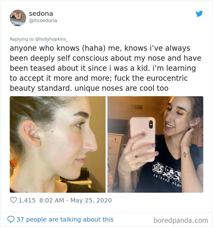 Women Are Posting Their Noses That Look Like “Before” Photos