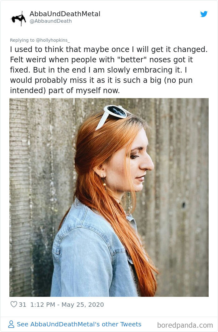 Women Are Posting Their Noses That Look Like “Before” Photos