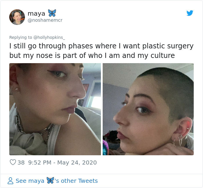 Women Are Posting Their Noses That Look Like “Before” Photos