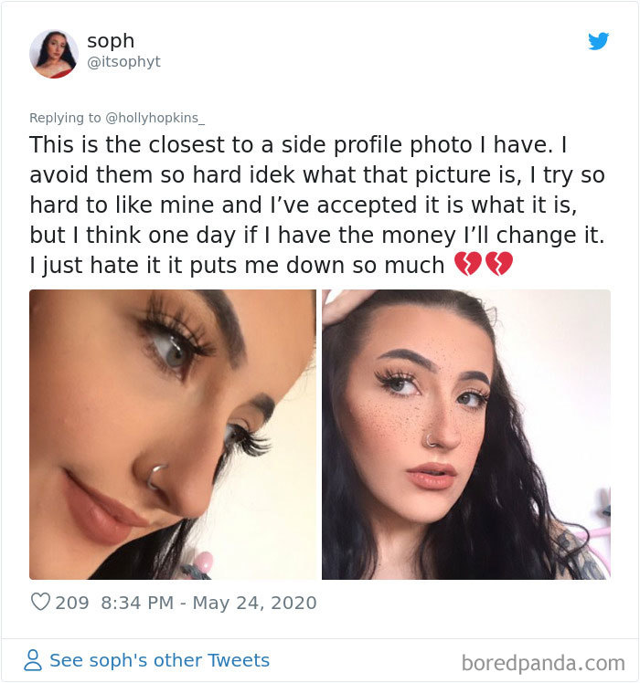 Women Are Posting Their Noses That Look Like “Before” Photos
