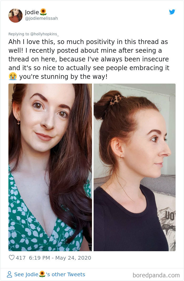 Women Are Posting Their Noses That Look Like “Before” Photos