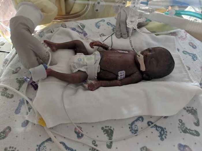 “I Adopted A ‘Perfect’ Micro-Preemie & Was By His Side As He Died 8 Days Later” “I Adopted A ‘Perfect’ Micro-Preemie & Was By His Side As He Died 8 Days Later”