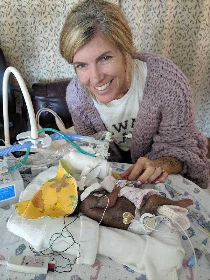 “I Adopted A ‘Perfect’ Micro-Preemie & Was By His Side As He Died 8 Days Later” “I Adopted A ‘Perfect’ Micro-Preemie & Was By His Side As He Died 8 Days Later”