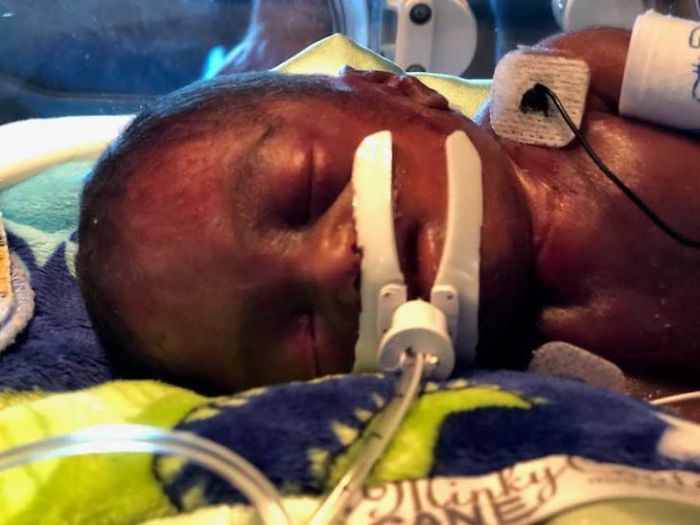 “I Adopted A ‘Perfect’ Micro-Preemie & Was By His Side As He Died 8 Days Later” “I Adopted A ‘Perfect’ Micro-Preemie & Was By His Side As He Died 8 Days Later”