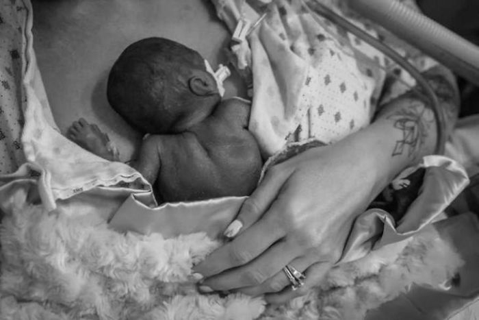 “I Adopted A ‘Perfect’ Micro-Preemie & Was By His Side As He Died 8 Days Later” “I Adopted A ‘Perfect’ Micro-Preemie & Was By His Side As He Died 8 Days Later”