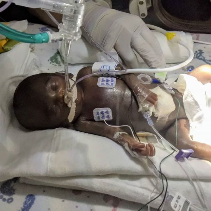 “I Adopted A ‘Perfect’ Micro-Preemie & Was By His Side As He Died 8 Days Later” “I Adopted A ‘Perfect’ Micro-Preemie & Was By His Side As He Died 8 Days Later”