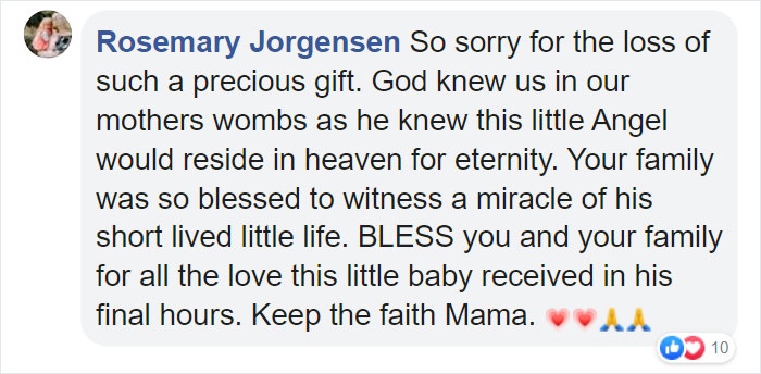 “I Adopted A ‘Perfect’ Micro-Preemie & Was By His Side As He Died 8 Days Later” “I Adopted A ‘Perfect’ Micro-Preemie & Was By His Side As He Died 8 Days Later”