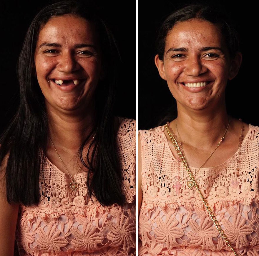 Brazilian Dentist Travels To Fix The Teeth Of Less-Fortunate People For Free And Here Are 30 New Transformations Brazilian Dentist Travels To Fix The Teeth Of Less-Fortunate People For Free And Here Are 30 New Transformations