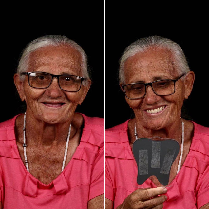 Brazilian Dentist Travels To Fix The Teeth Of Less-Fortunate People For Free And Here Are 30 New Transformations Brazilian Dentist Travels To Fix The Teeth Of Less-Fortunate People For Free And Here Are 30 New Transformations
