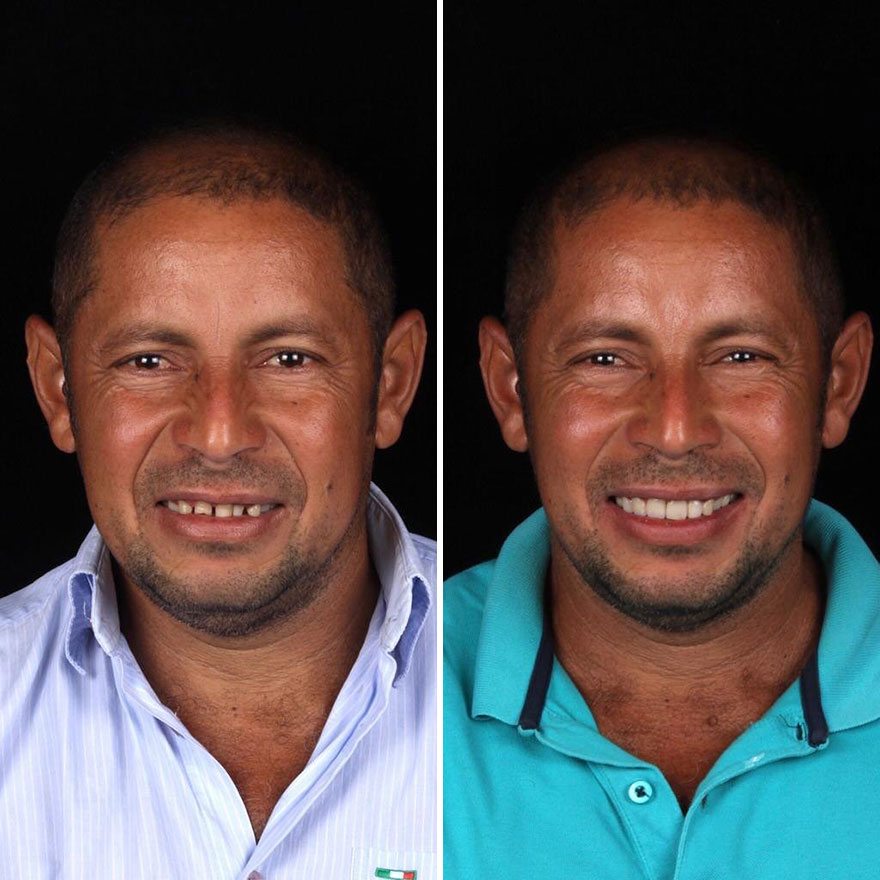 Brazilian Dentist Travels To Fix The Teeth Of Less-Fortunate People For Free And Here Are 30 New Transformations Brazilian Dentist Travels To Fix The Teeth Of Less-Fortunate People For Free And Here Are 30 New Transformations
