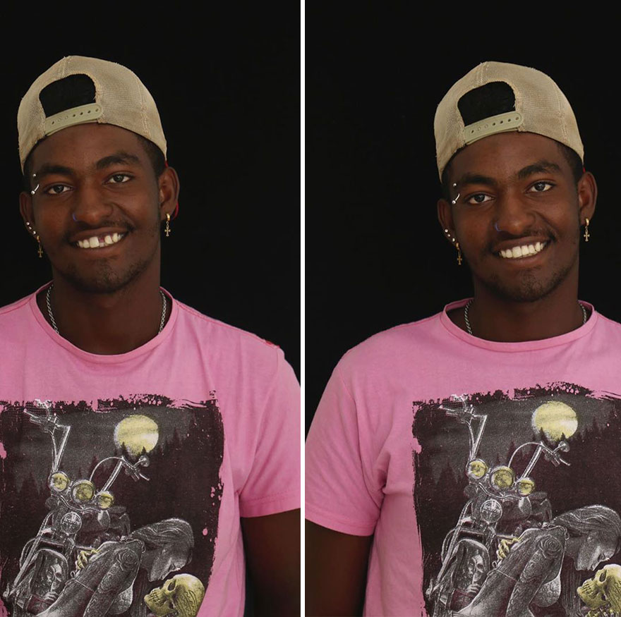 Brazilian Dentist Travels To Fix The Teeth Of Less-Fortunate People For Free And Here Are 30 New Transformations Brazilian Dentist Travels To Fix The Teeth Of Less-Fortunate People For Free And Here Are 30 New Transformations