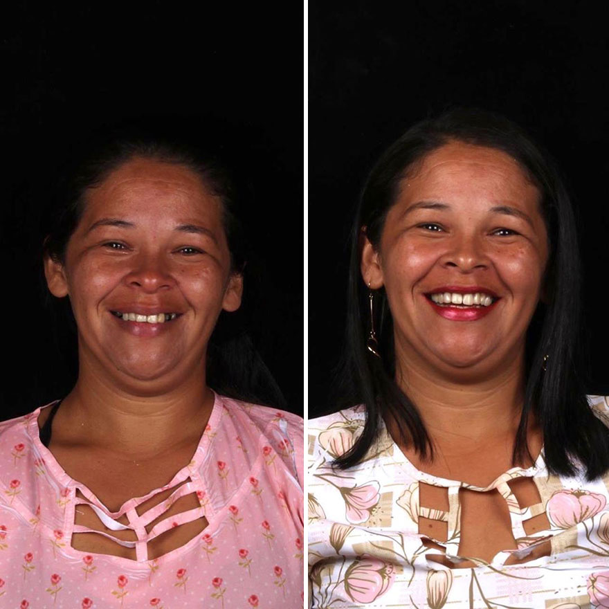 Brazilian Dentist Travels To Fix The Teeth Of Less-Fortunate People For Free And Here Are 30 New Transformations Brazilian Dentist Travels To Fix The Teeth Of Less-Fortunate People For Free And Here Are 30 New Transformations