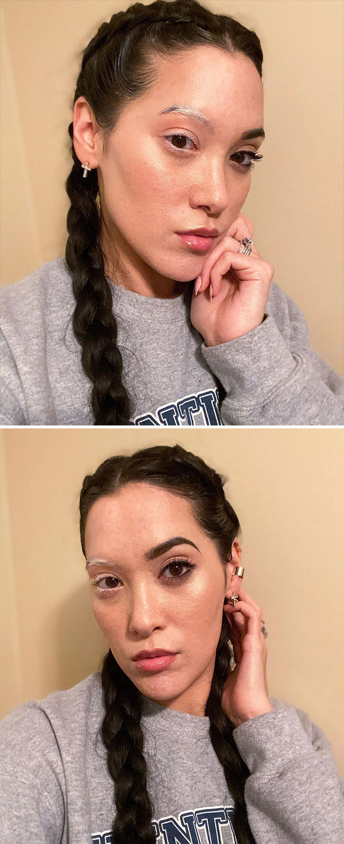 39 People Whose Genetics Made Them Unique 39 People Whose Genetics Made Them Unique