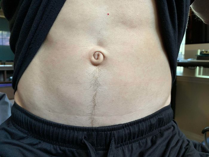 39 People Whose Genetics Made Them Unique 39 People Whose Genetics Made Them Unique