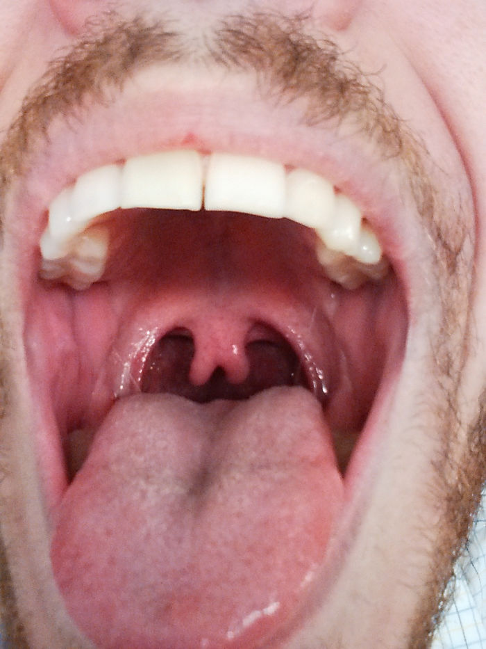 39 People Whose Genetics Made Them Unique 39 People Whose Genetics Made Them Unique