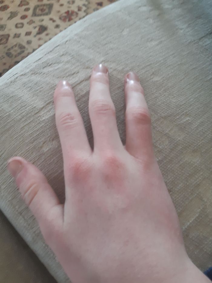 39 People Whose Genetics Made Them Unique 39 People Whose Genetics Made Them Unique