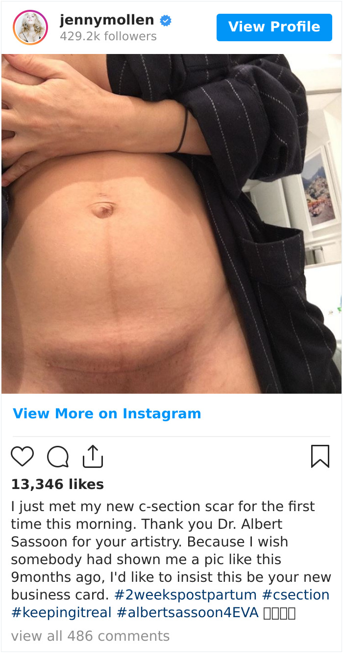 30 Celebs Who Didn’t Hide Their Postpartum Bodies To Maintain An Unrealistic Body Image 30 Celebs Who Didn’t Hide Their Postpartum Bodies To Maintain An Unrealistic Body Image