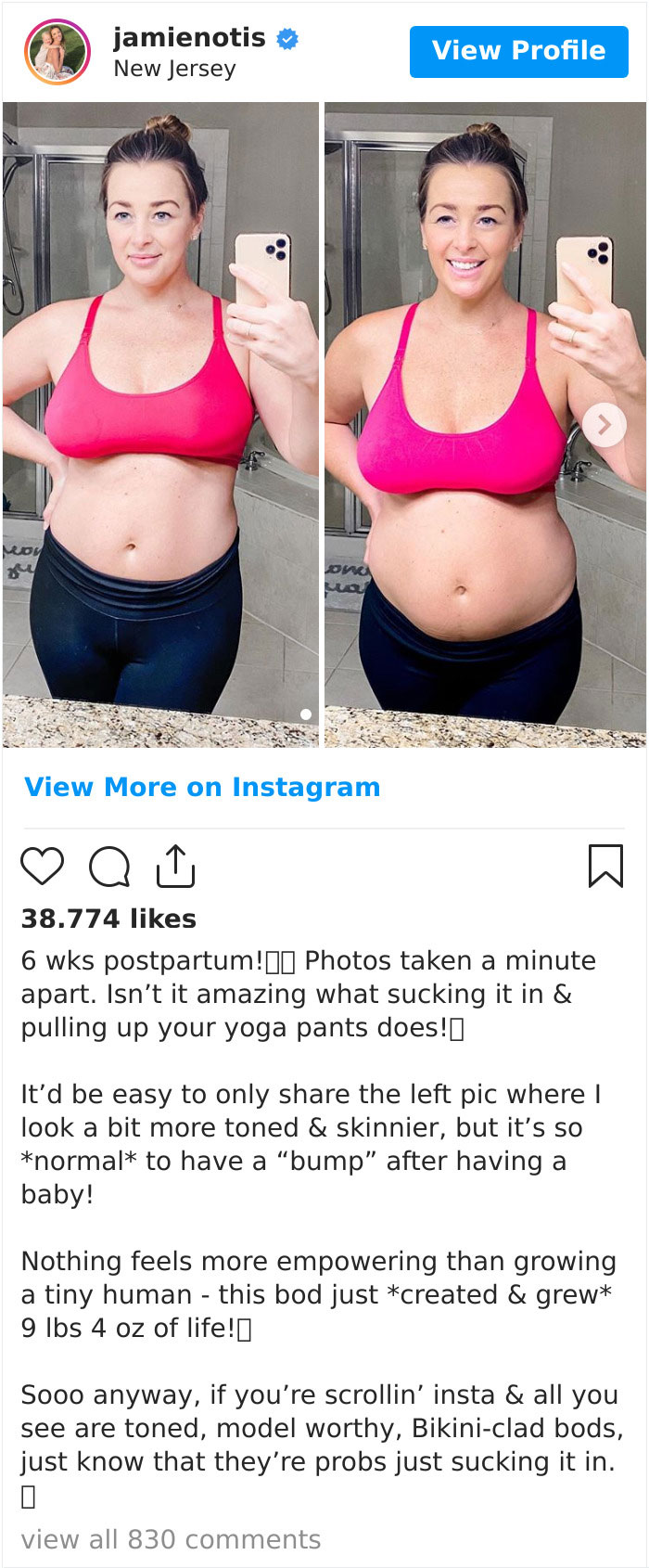 30 Celebs Who Didn’t Hide Their Postpartum Bodies To Maintain An Unrealistic Body Image 30 Celebs Who Didn’t Hide Their Postpartum Bodies To Maintain An Unrealistic Body Image