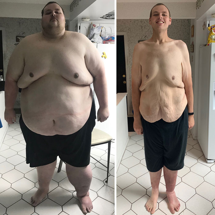 50 Times People Surprised Everyone By Losing So Much Weight They Looked Like A Different Person (New Pics) 50 Times People Surprised Everyone By Losing So Much Weight They Looked Like A Different Person (New Pics)