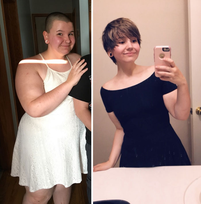 50 Times People Surprised Everyone By Losing So Much Weight They Looked Like A Different Person (New Pics) 50 Times People Surprised Everyone By Losing So Much Weight They Looked Like A Different Person (New Pics)