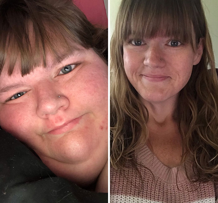 50 Times People Surprised Everyone By Losing So Much Weight They Looked Like A Different Person (New Pics) 50 Times People Surprised Everyone By Losing So Much Weight They Looked Like A Different Person (New Pics)